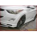 SEQUENCE QUANTUM EDITION KIT HYUNDAI ELANTRA 2010-13